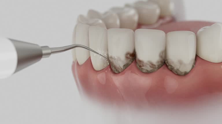 Reliable Dental Implants contractor in Beulah, ND by Smile Center Dentistry